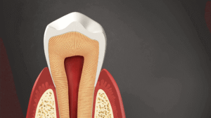 Tooth Cross Section
