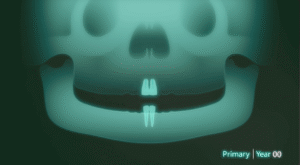 Teeth Eruption Sequence