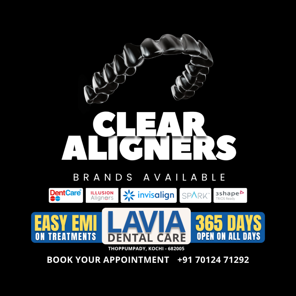 Clear Aligners & Braces Cost in Kochi: 2026 Treatment Guide